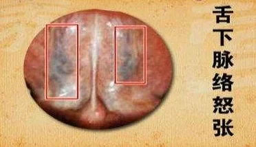 《凡人修仙传手游》特色玩法深度剖析:经脉系统详细介绍与玩法分析 《凡人修仙传手游》特色玩法深度剖析:经脉系统详细介绍与玩法分析