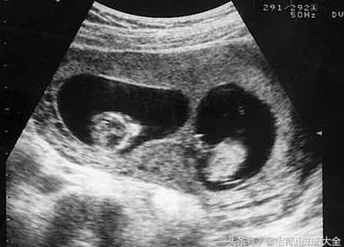 如果我怀了我儿子的孩子怎么办DNA检测结果显示孩子父亲另有其人