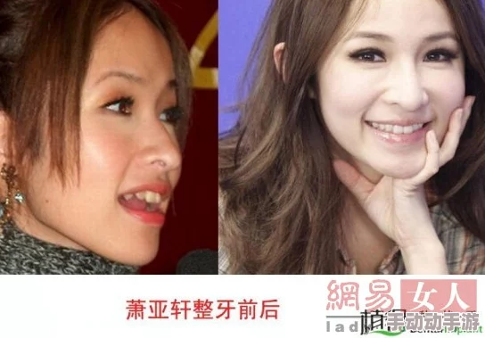 震惊!女星深夜急诊锕锕锕锕锕锕锕疼疑似隆胸后遗症发作紧急送医情况危急 震惊!女星深夜急诊锕锕锕锕锕锕锕疼疑似隆胸后遗症发作紧急送医情况危急