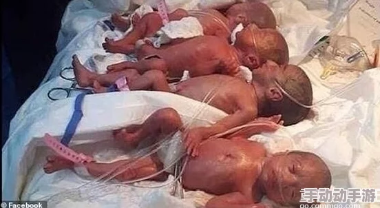 冲刺美妇怀孕迎来三胞胎喜讯母子平安 冲刺美妇怀孕迎来三胞胎喜讯母子平安