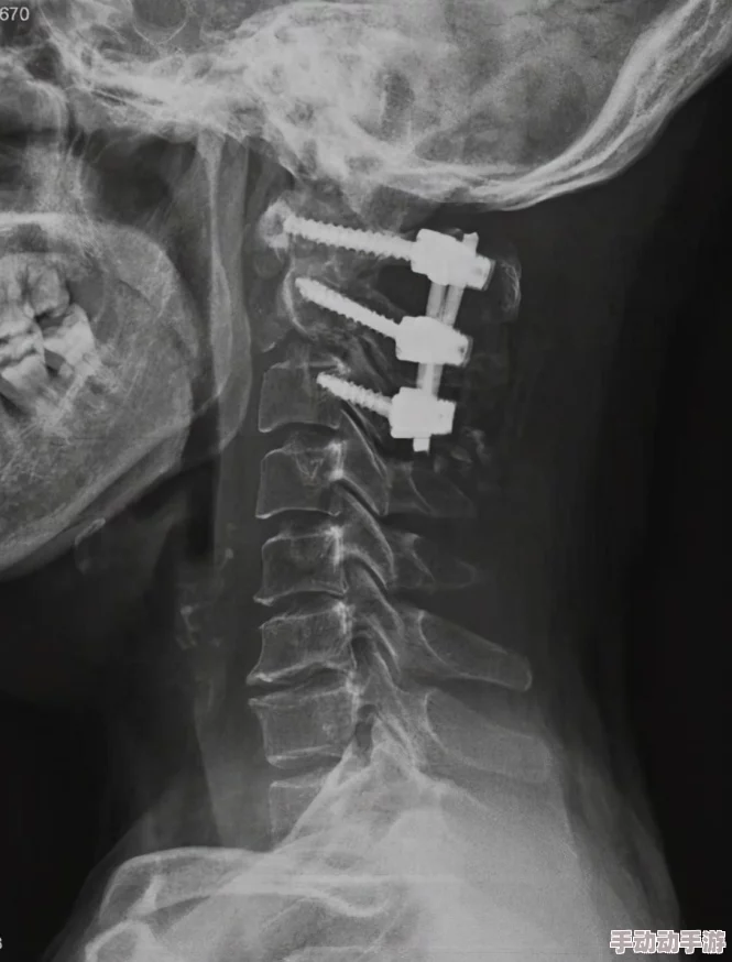 尘白禁区记忆嵌片使用方法详解:操作步骤与注意事项 尘白禁区记忆嵌片使用方法详解:操作步骤与注意事项